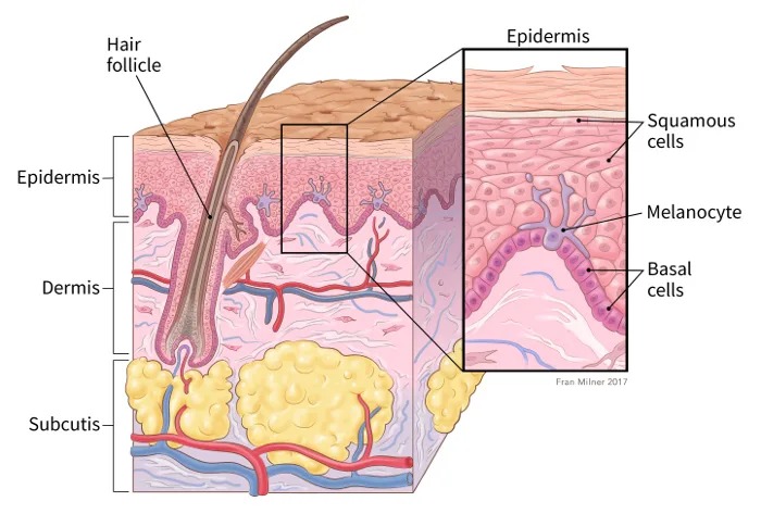 Skin Cancer